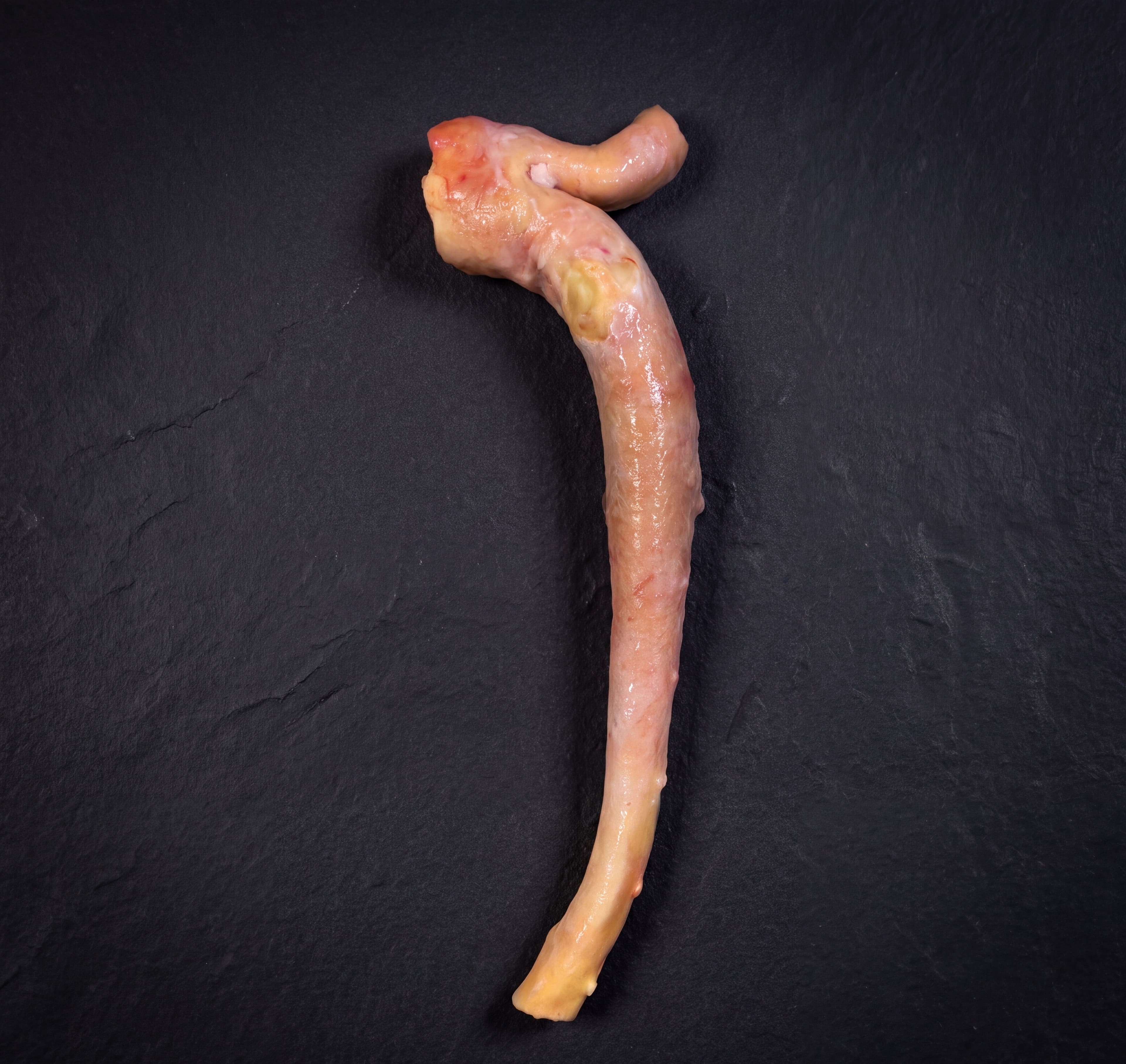 Aorta