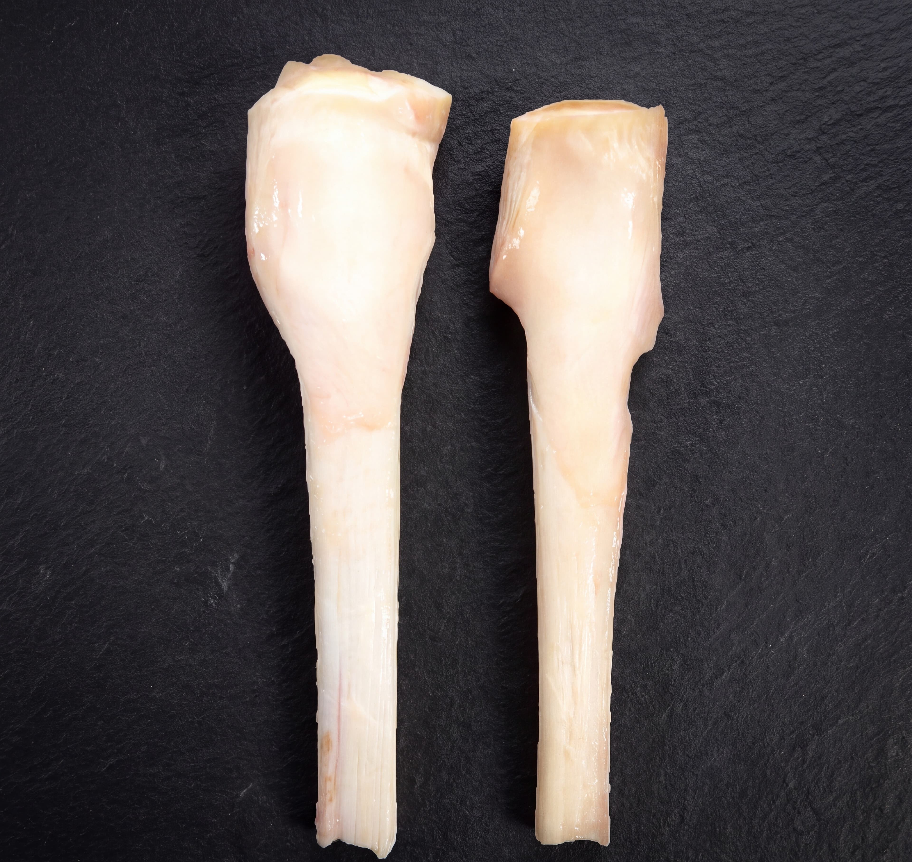 Knee Tendon
