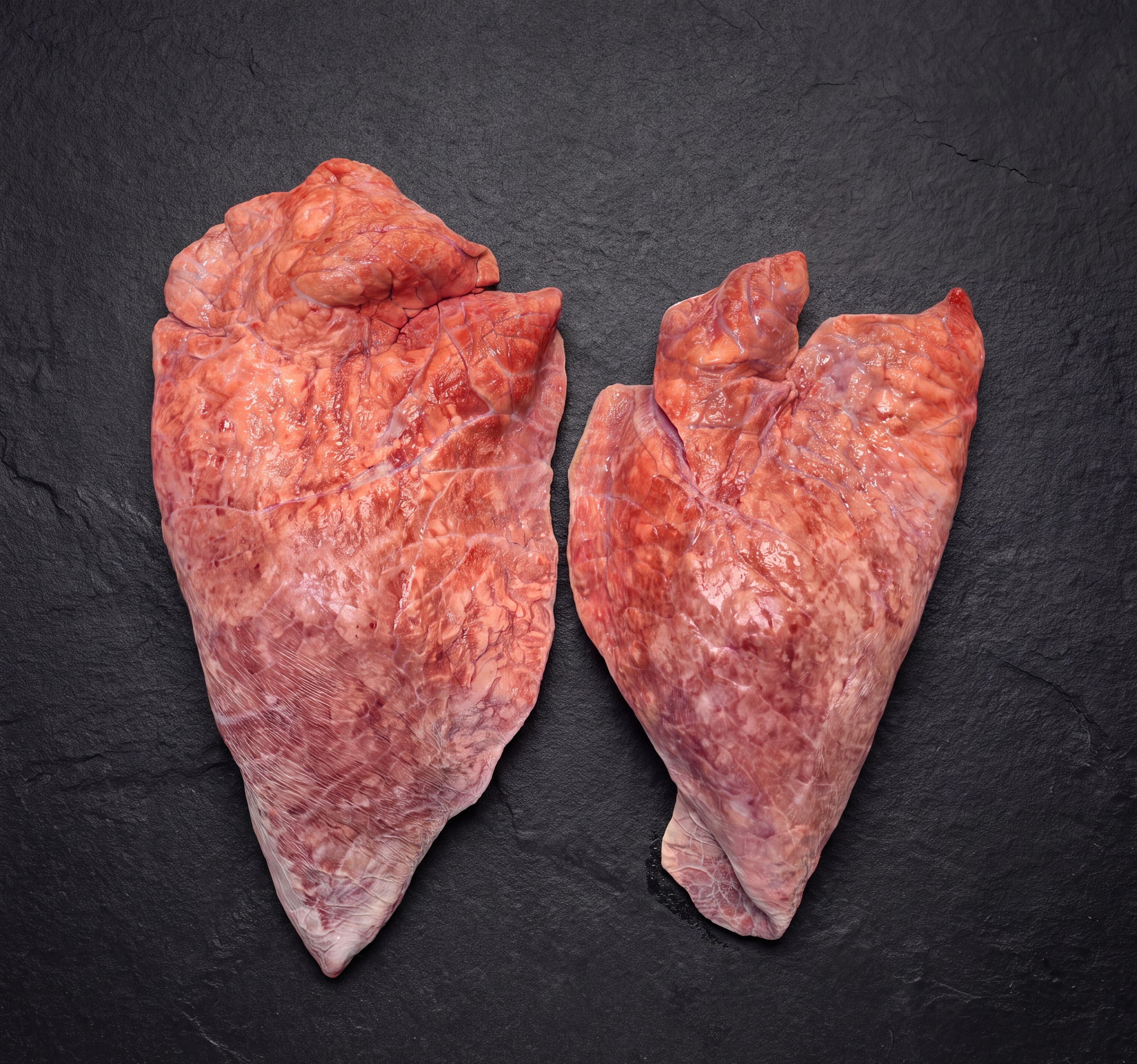 Lungs