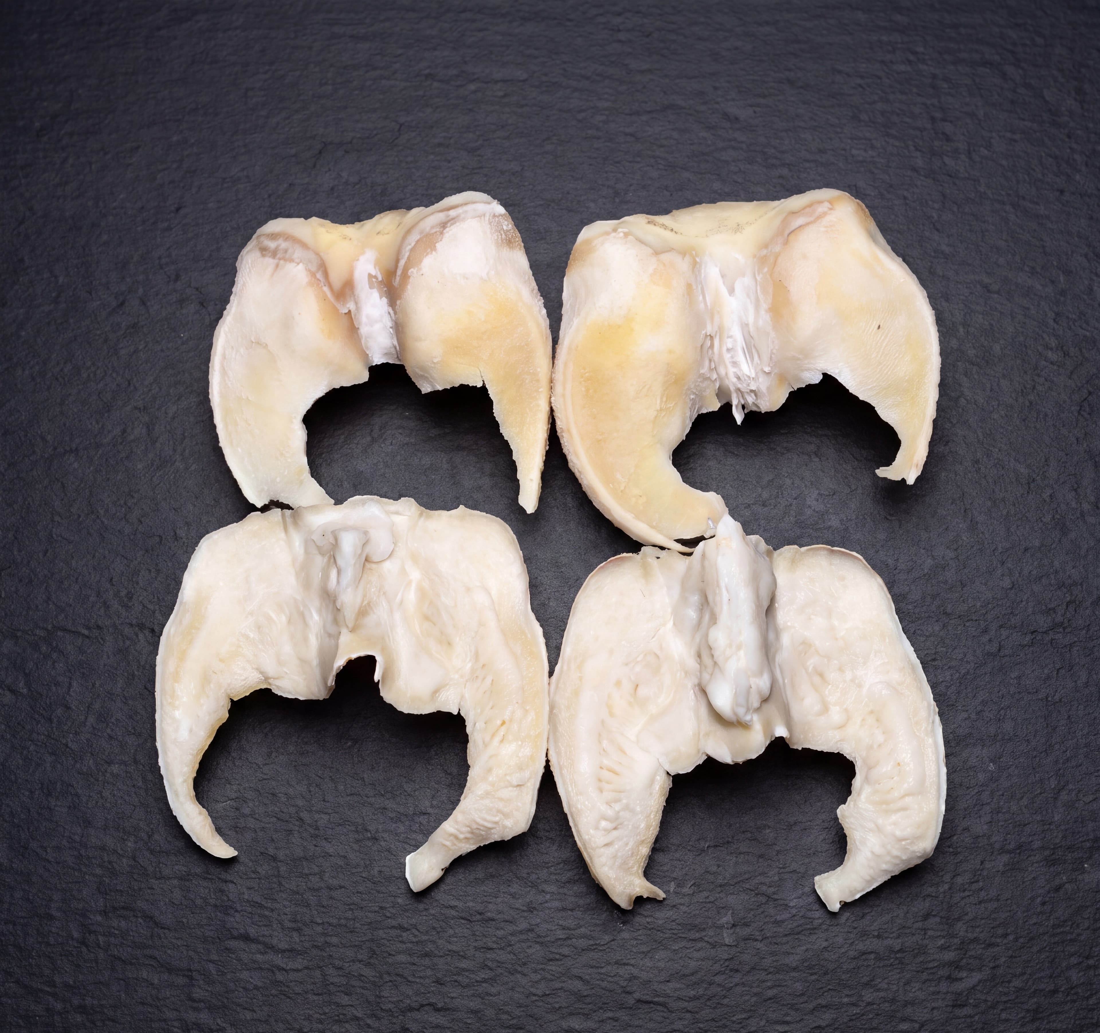 Nail Meat