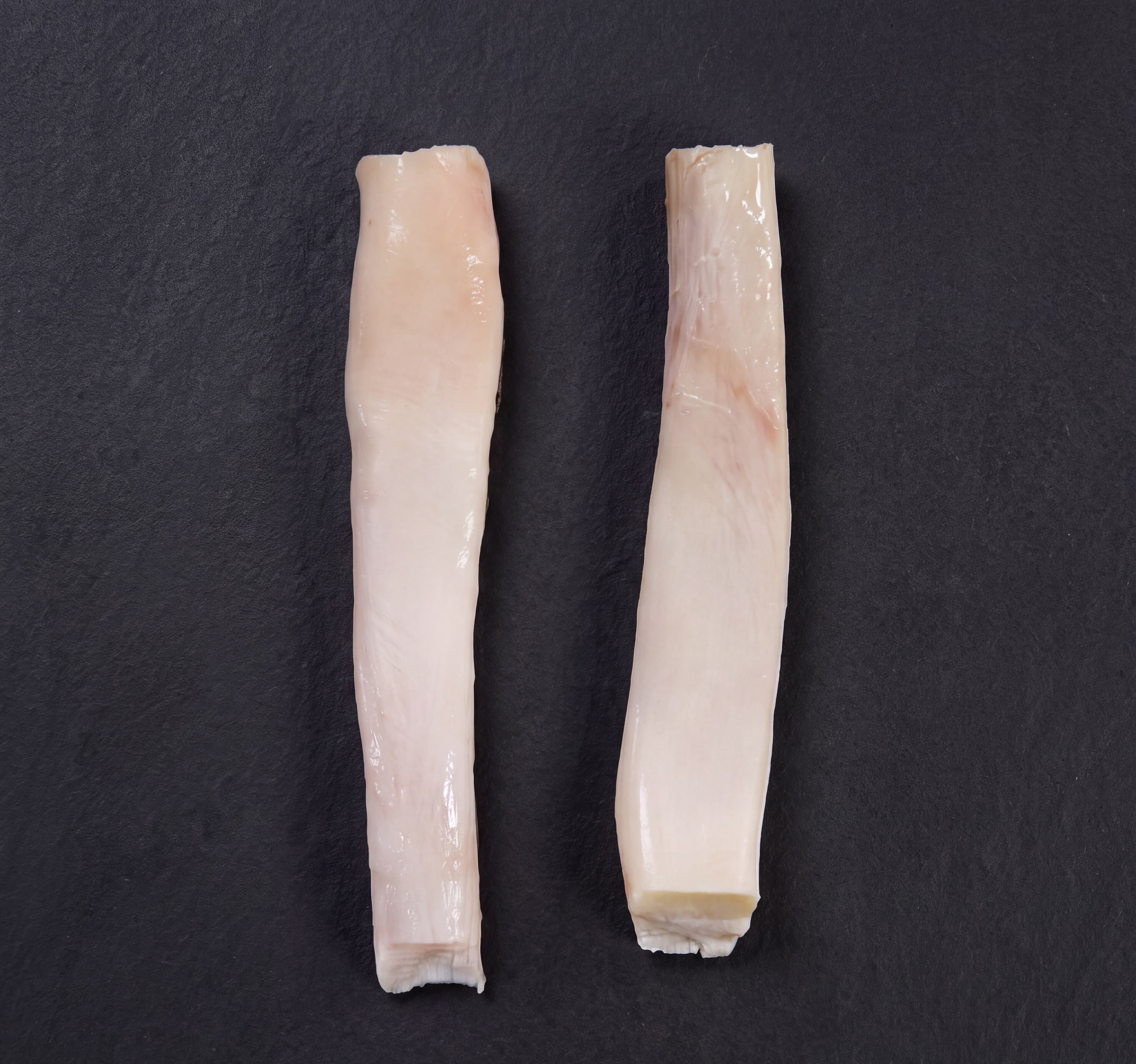 Short Tendon
