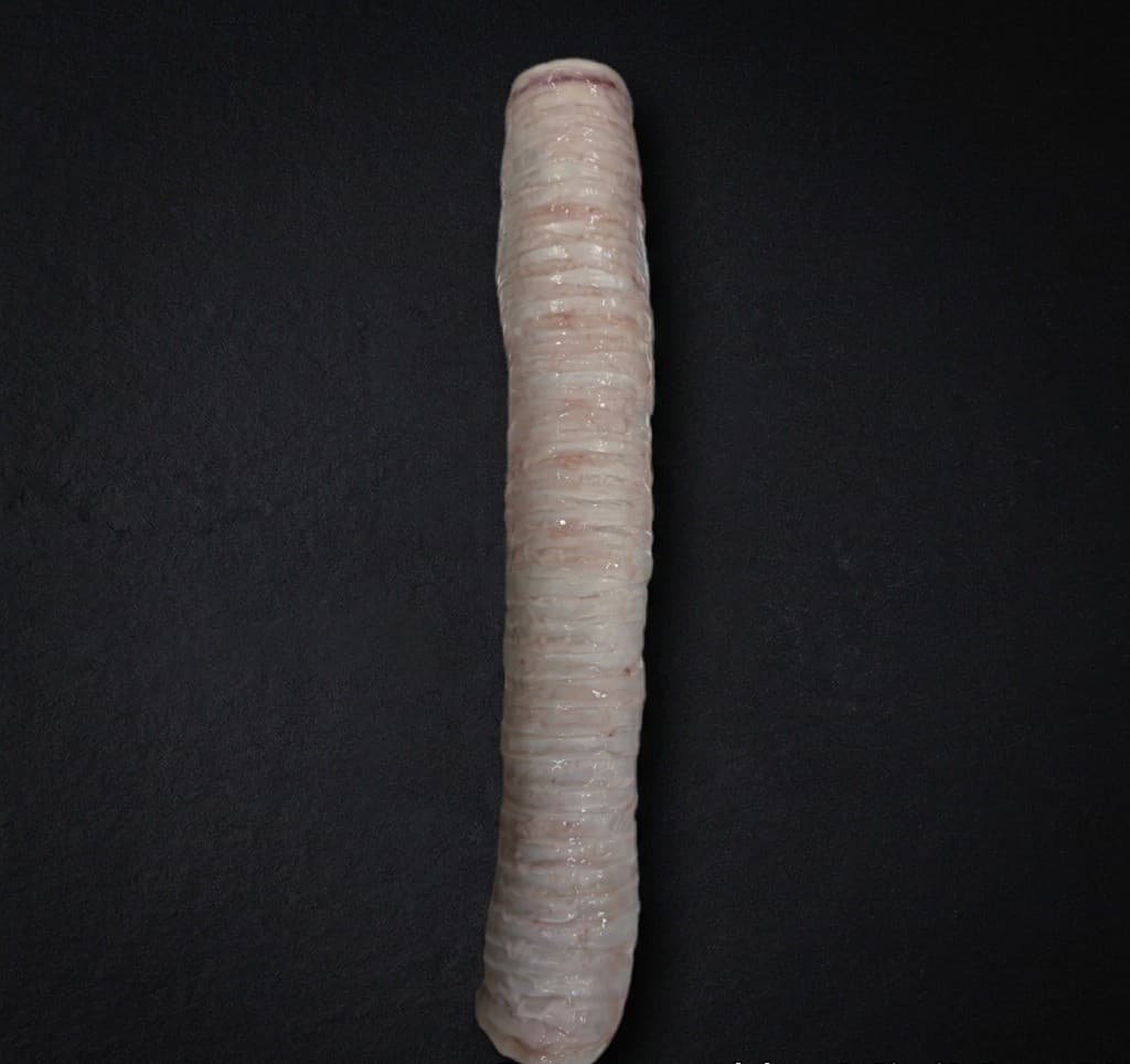 Trachea